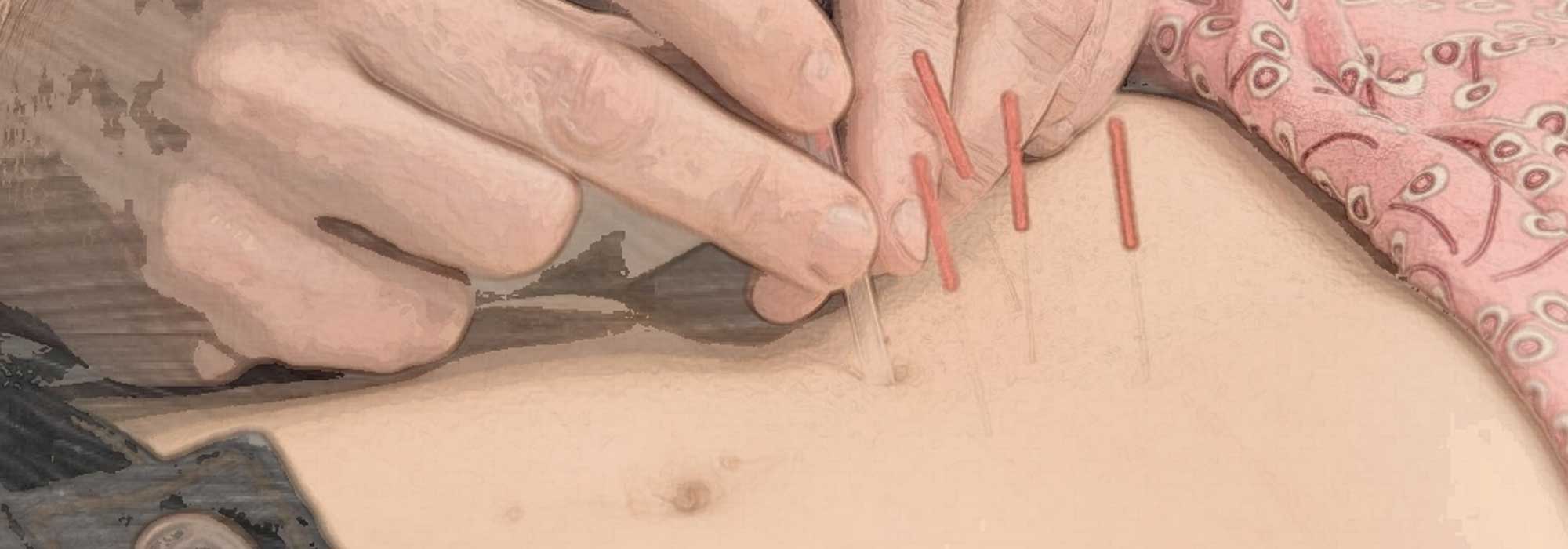 Fertility Treatment with the indomitable energy of TCM