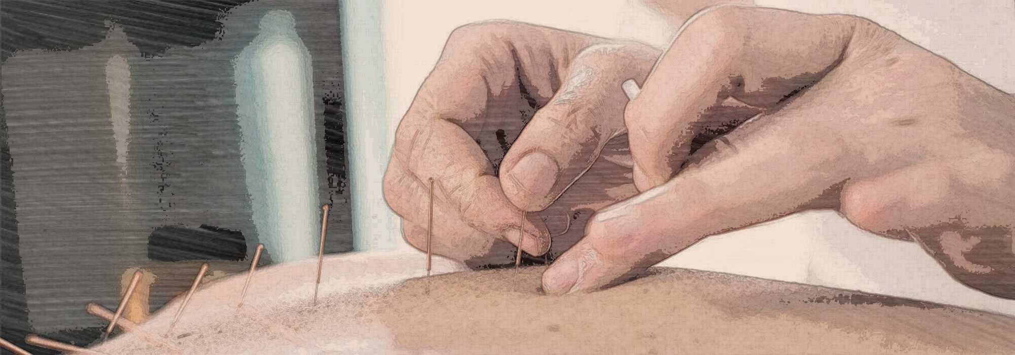 Stroke Recovery by fusing the powerful TCM with Western Medicine
